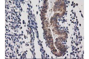 Image no. 3 for anti-Destrin (Actin Depolymerizing Factor) (DSTN) antibody (ABIN1497908)