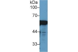 Detection of VIM in Human 293T cell lysate using Monoclonal Antibody to Vimentin (VIM)