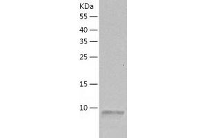 Western Blotting (WB) image for Chemokine (C-X-C Motif) Ligand 12 (CXCL12) (AA 22-93) protein (His-IF2DI Tag) (ABIN7125220)
