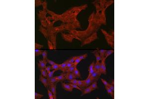 Immunofluorescence analysis of C6 cells using TFEB antibody (ABIN6128819, ABIN6149043, ABIN6149045 and ABIN6223149) at dilution of 1:100. (TFEB anticorps)