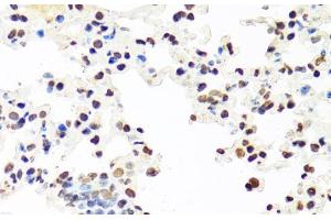 Immunohistochemistry of paraffin-embedded Mouse lung using SFPQ Polyclonal Antibody at dilution of 1:100 (40x lens).