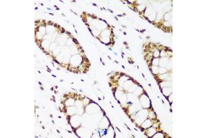 Immunohistochemistry of paraffin-embedded human colon using PCNA antibody (ABIN1874056) at dilution of 1:200 (40x lens). (PCNA anticorps)