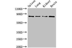 Western Blot Positive WB detected in: Mouse spleen tissue, Mouse lung tissue, Mouse kidney tissue, Mouse brain tissue All lanes: PRMT7 antibody at 6. (PRMT7 anticorps  (AA 285-390))