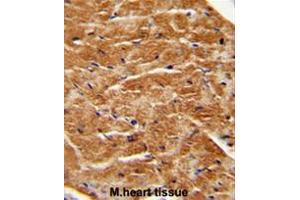 FGF7 antibody (Center) immunohistochemistry analysis in formalin fixed and paraffin embedded human M. (FGF7 anticorps  (Middle Region))