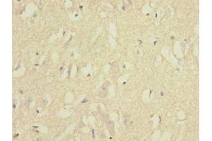 Immunohistochemistry of paraffin-embedded human brain tissue using ABIN7151859 at dilution of 1:100 (EPH Receptor B1 anticorps  (AA 260-500))
