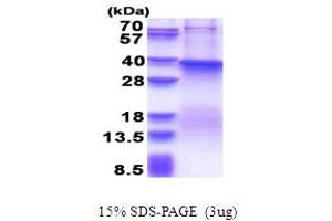 SDS-PAGE (SDS) image for Fucosyltransferase 7 (Alpha (1,3) Fucosyltransferase) (FUT7) (AA 37-342) protein (His tag) (ABIN6387411) (FUT7 Protein (AA 37-342) (His tag))