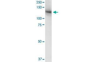 MICAL1 monoclonal antibody (M06), clone 3D12.