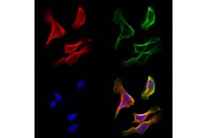 ABIN6265362 and ABIN6272951 staining Hela cells by IF/ICC. (SUCLA2 anticorps  (Internal Region))