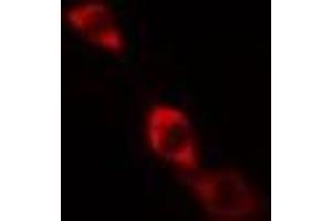 ABIN6268977 staining HeLa cells by IF/ICC.
