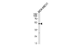 MICA Antibody (Center) (ABIN652566 and ABIN2842381) western blot analysis in MDA-MB-231 cell line lysates (35 μg/lane). (MICA anticorps  (AA 68-97))