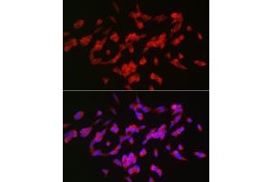 Immunofluorescence analysis of SH-SY5Y cells using G Rabbit pAb (ABIN6127469, ABIN6140954, ABIN6140955 and ABIN6221997) at dilution of 1:25 (40x lens). (GAP43 anticorps  (AA 1-238))