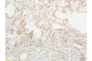 Formalin-fixed and paraffin embedded mouse uterus tissue labeled with Anti-ABP/SHBG Polyclonal Antibody, Unconjugated  at 1:200 followed by conjugation to the secondary antibody and DAB staining (SHBG anticorps  (AA 51-150))