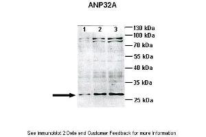 Lanes:   Lane1: 10ug mouse cortex brain lysate Lane2: 25ug mouse cortex brain lysate Lane3: 40ug mouse cortex brain lysate  Primary Antibody Dilution:   1:1000  Secondary Antibody:   Anti-rabbit HRP  Secondary Antibody Dilution:   1:2000  Gene Name:   ANP32A  Submitted by:   Anonymous