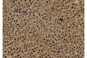 ABIN6279036 at 1/100 staining Rat liver tissue by IHC-P.
