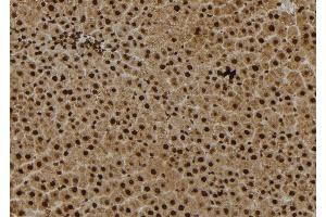 ABIN6279036 at 1/100 staining Rat liver tissue by IHC-P. (RPS27 anticorps  (Internal Region))