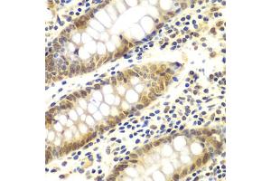 Immunohistochemistry of paraffin-embedded human colon using GNB2L1 antibody (ABIN6292957) at dilution of 1:100 (40x lens).