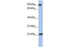 WB Suggested Anti-TMED10 Antibody Titration: 0. (TMED10 anticorps  (Middle Region))