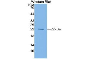Detection of Recombinant HDAC4, Mouse using Polyclonal Antibody to Histone Deacetylase 4 (HDAC4) (HDAC4 anticorps  (AA 904-1076))