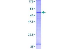 Image no. 1 for Fatty Acid Desaturase 1 (FADS1) (AA 1-444) protein (GST tag) (ABIN1353357)