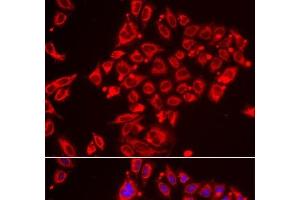 Immunofluorescence analysis of HeLa cells using ST3GAL3 Polyclonal Antibody (ST3GAL3 anticorps)
