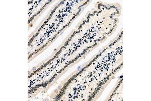 Immunohistochemistry of paraffin embedded mouse duodenum using SRRM2 (ABIN7075555) at dilution of 1:650 (300x lens)