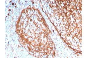 Formalin-fixed, paraffin-embedded human tonsil stained with CD11b Monospecific Mouse Monoclonal Antibody (ITGAM/3338).