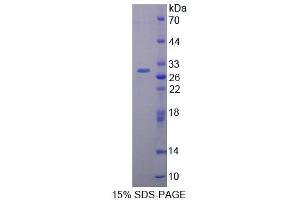 SDS-PAGE analysis of Rat PCM1 Protein. (PCM1 Protéine)