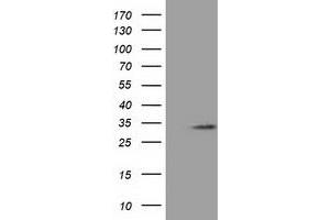 HEK293T cells were transfected with the pCMV6-ENTRY control (Left lane) or pCMV6-ENTRY C16orf72 (Right lane) cDNA for 48 hrs and lysed. (C16orf72 anticorps)