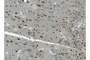 IHC analysis of PCBP2/hnRNP E2 using anti-PCBP2/hnRNP E2 antibody (ABIN7600449). (PCBP2 anticorps  (AA 197-276))