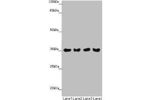 Western blot All lanes: TOMM34 antibody at 1. (TOMM34 anticorps  (AA 1-309))