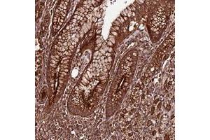 Immunohistochemical staining of human stomach with FAM186A polyclonal antibody  shows strong cytoplasmic positivity in glandular cells. (FAM186A anticorps)