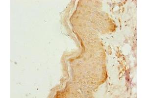 Immunohistochemistry of paraffin-embedded human skin tissue using ABIN7148168 at dilution of 1:100 (CCDC89 anticorps  (AA 1-200))