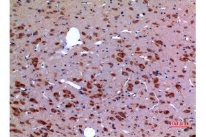 Immunohistochemistry (IHC) analysis of paraffin-embedded Rat Brain, antibody was diluted at 1:100.