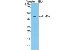 Western blot analysis of the recombinant protein. (Osteocalcin anticorps  (AA 11-98))
