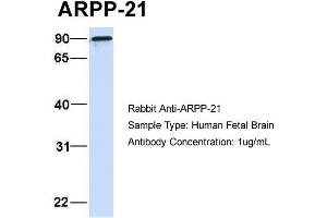 Host:  Rabbit  Target Name:  ARPP-21  Sample Type:  Human Fetal Brain  Antibody Dilution:  1. (ARPP21 anticorps  (N-Term))