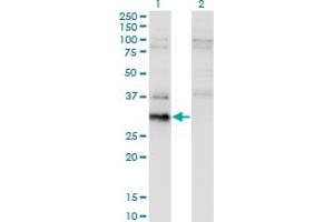 Western Blot analysis of BCL7B expression in transfected 293T cell line by BCL7B monoclonal antibody (M02), clone 4G1. (BCL7B anticorps  (AA 124-202))