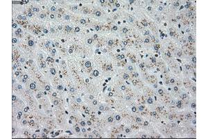 Image no. 5 for anti-Checkpoint Kinase 2 (CHEK2) antibody (ABIN1497496)