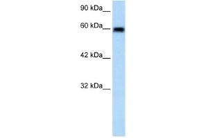 WB Suggested Anti-VMD2L2 Antibody Titration:  1. (Bestrophin 4 anticorps  (N-Term))