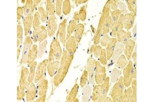 Immunohistochemistry of paraffin-embedded Rat heart using CA3 Polyclonal Antibody at dilution of 1:100 (40x lens).