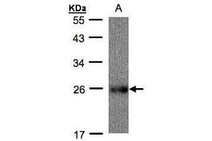 WB Image Sample(30 ug whole cell lysate) A: Raji, 12% SDS PAGE antibody diluted at 1:500 (UQCRFS1 anticorps)