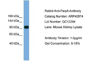 WB Suggested Anti-Parp8 Antibody Titration:  0. (PARP8 anticorps  (N-Term))