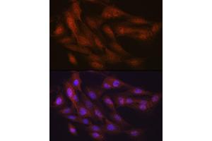 Immunofluorescence analysis of C6 cells using K48-linkage Specific Ubiquitin Rabbit mAb (ABIN1680189, ABIN3017871, ABIN3017872 and ABIN7101530) at dilution of 1:100 (40x lens).