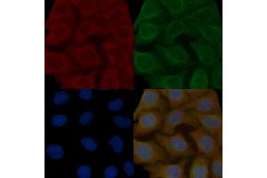Synapsin I Mouse Monoclonal Antibody staining Hela cells by IF/ICC. (SYN1 anticorps  (N-Term))