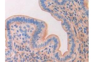 Detection of CD34 in Mouse Uterus Tissue using Polyclonal Antibody to Cluster Of Differentiation 34 (CD34)