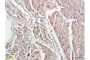 anti-rho-Associated, Coiled-Coil Containing Protein Kinase 1 (ROCK1) (pSer456), (pThr455) antibody