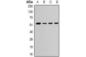 Western blot analysis of CaMK1 gamma expression in PC12 (A), A673 (B), mouse liver (C), rat brain (D) whole cell lysates. (CAMK1G anticorps)