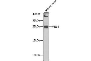 Western blot analysis of extracts of mouse brain, using VTI1B antibody (ABIN6132781, ABIN6150162, ABIN6150163 and ABIN6222854) at 1:1000 dilution. (VTI1B anticorps  (AA 1-210))