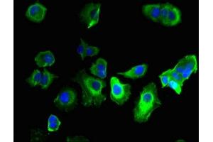anti-gamma-aminobutyric Acid (GABA) Receptor, theta (GABRQ) (AA 348-611) antibody