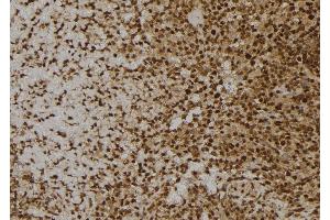 ABIN6273600 at 1/100 staining Human spleen tissue by IHC-P.