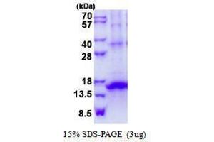 Figure annotation denotes ug of protein loaded and % gel used. (KLRG1 Protéine)